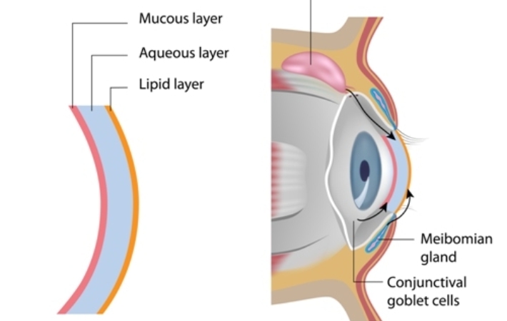 A diagram of how the meibomian glands are positioned relative to the eyeball and the different layers of tear film